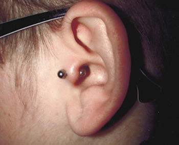 Looking for unique  Body Piercing Galleries? tragus
