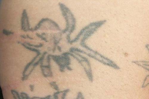 Tattoos Gone Bad - Spidolobstapus